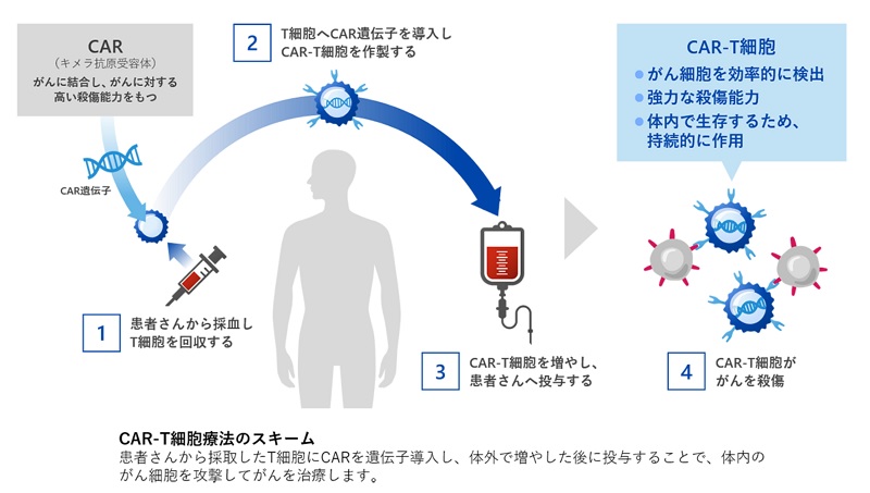 CAR-T細胞療法