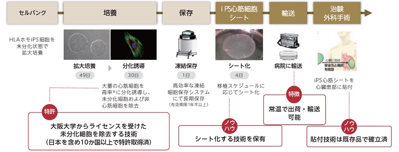 ヒトiPS細胞由来心筋細胞シートの作製手順