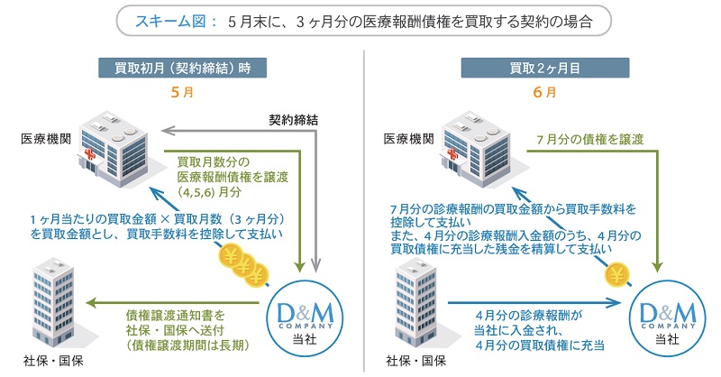 債権買取スキーム