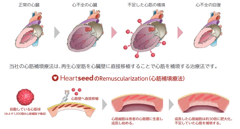 Heartseedの治療法